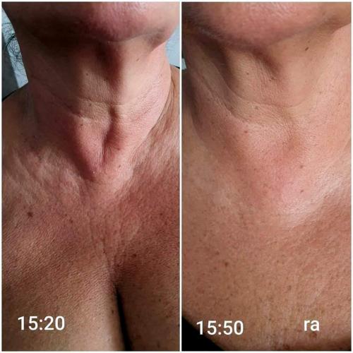 FB IMG 1644988950365